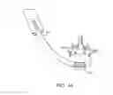 Fig. 17 - Apparatus for spinal fusion
