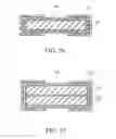 Fig. 20 - Apparatus for spinal fusion