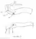 Fig. 02 - Methods and devices for endoscopically creating an anastomosis