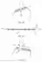 Fig. 50 - Methods and Devices to Treat Obesity