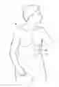 Fig. 01 - Apparatus for treating obesity