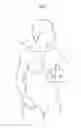 Fig. 02 - Apparatus for treating obesity