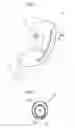 Fig. 03 - Apparatus for treating obesity