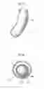 Fig. 05 - Apparatus for treating obesity