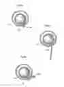 Fig. 06 - Apparatus for treating obesity