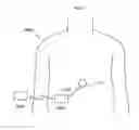 Fig. 30 - Apparatus for treating obesity