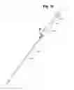 Fig. 11 - Metal vascular aperture closure device