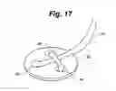 Fig. 18 - Metal vascular aperture closure device