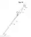 Fig. 11 - Metal vascular aperture closure device