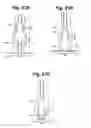 Fig. 22 - Metal vascular aperture closure device