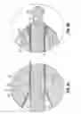 Fig. 03 - INTERSPINOUS SPACER