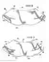 Fig. 05 - Methods and apparatuses for stabilizing the spine through an access device