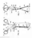 Fig. 10 - Methods and apparatuses for stabilizing the spine through an access device
