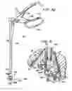Fig. 17 - Methods and apparatuses for stabilizing the spine through an access device