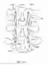 Fig. 37 - Methods and apparatuses for stabilizing the spine through an access device