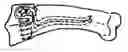 Fig. 01 - FIXED ANGLE DUAL PRONG PIN FIXATION SYSTEM