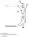 Fig. 01 - Orbit distractor