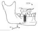 Fig. 01 - APPARATUS AND METHOD FOR MOVEMENT OF ELECTRICITY OR FLUID INTO AND OUT OF THE BODY
