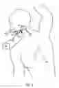 Fig. 08 - APPARATUS AND METHOD FOR MOVEMENT OF ELECTRICITY OR FLUID INTO AND OUT OF THE BODY