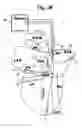 Fig. 03 - Method and device for three-stage atrial cardioversion therapy