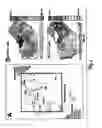 Fig. 05 - Method and device for three-stage atrial cardioversion therapy