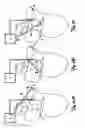 Fig. 07 - Method and device for three-stage atrial cardioversion therapy