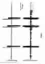 Fig. 24 - Method and device for three-stage atrial cardioversion therapy