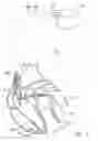 Fig. 02 - Method and system for identifying a potential lead failure in an implantable medical device