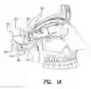Fig. 02 - SKULL-MOUNTED ELECTRICAL STIMULATION SYSTEM AND METHOD FOR TREATING PATIENTS