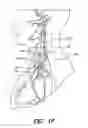 Fig. 07 - SKULL-MOUNTED ELECTRICAL STIMULATION SYSTEM AND METHOD FOR TREATING PATIENTS