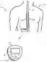 Fig. 01 - Therapy adjustment