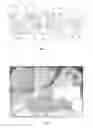 Fig. 02 - Suction electrode-based medical instrument and system including the medical instrument for therapeutic electrotherapy