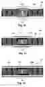 Fig. 08 - Systems and methods of making and using support elements for elongated members of implantable electric stimulation systems