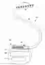 Fig. 01 - PIGGY-BACK PERCUTANEOUS LEAD INSERTION KIT