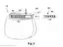 Fig. 04 - PIGGY-BACK PERCUTANEOUS LEAD INSERTION KIT