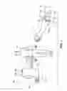 Fig. 02 - Self adjusting venous equalizing graft and endothelial lining therefor