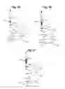 Fig. 09 - Self adjusting venous equalizing graft and endothelial lining therefor