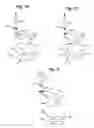 Fig. 10 - Self adjusting venous equalizing graft and endothelial lining therefor