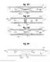 Fig. 12 - Self adjusting venous equalizing graft and endothelial lining therefor