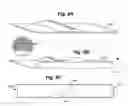 Fig. 14 - Self adjusting venous equalizing graft and endothelial lining therefor