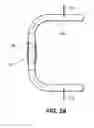 Fig. 03 - Endothelial scaffold graft and method therefor