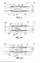 Fig. 05 - Endothelial scaffold graft and method therefor