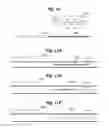 Fig. 15 - Endothelial scaffold graft and method therefor