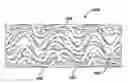 Fig. 01 - Rapamycin reservoir eluting stent