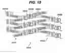 Fig. 09 - Rapamycin reservoir eluting stent