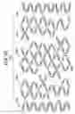 Fig. 20 - Rapamycin reservoir eluting stent