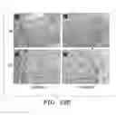 Fig. 18 - PROSTHETIC FABRIC STRUCTURE
