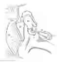 Fig. 01 - Radiopaque middle ear prosthesis