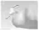 Fig. 01 - PARTIAL JOINT RESURFACING IMPLANT, INSTRUMENTATION AND METHOD
