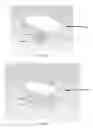 Fig. 03 - PARTIAL JOINT RESURFACING IMPLANT, INSTRUMENTATION AND METHOD